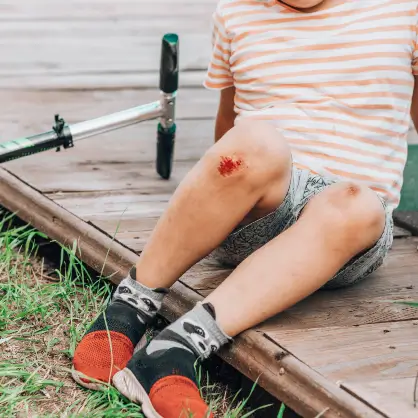 A child wearing a striped shirt and shorts sitting on a wooden deck, showing a red scrape on their knee with a scooter lying nearby
