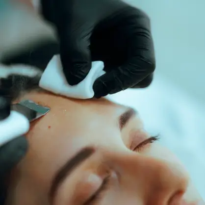A close-up of a person wearing black gloves pressing a white gauze pad onto another person's forehead during a skincare or medical treatment